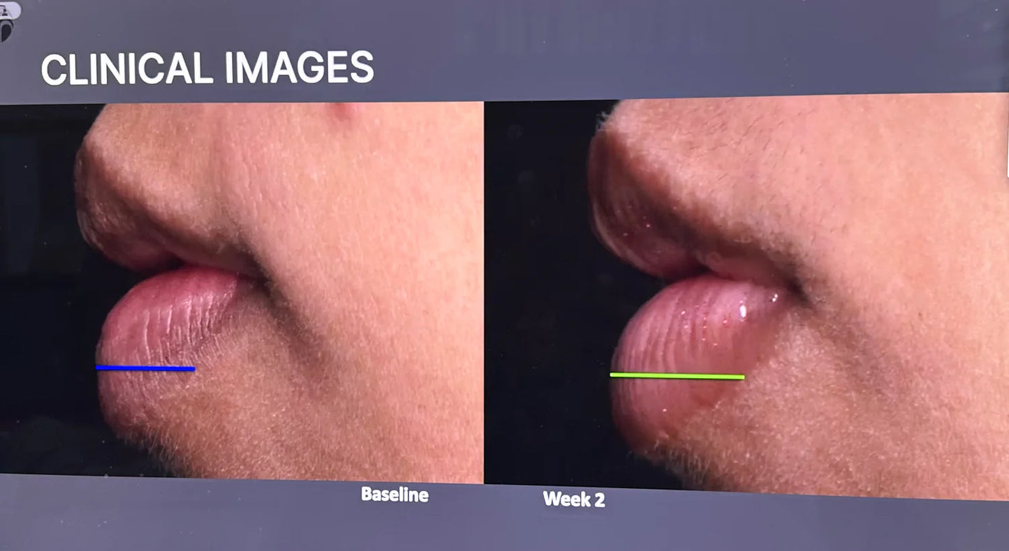 Lip Peptide Gloss
