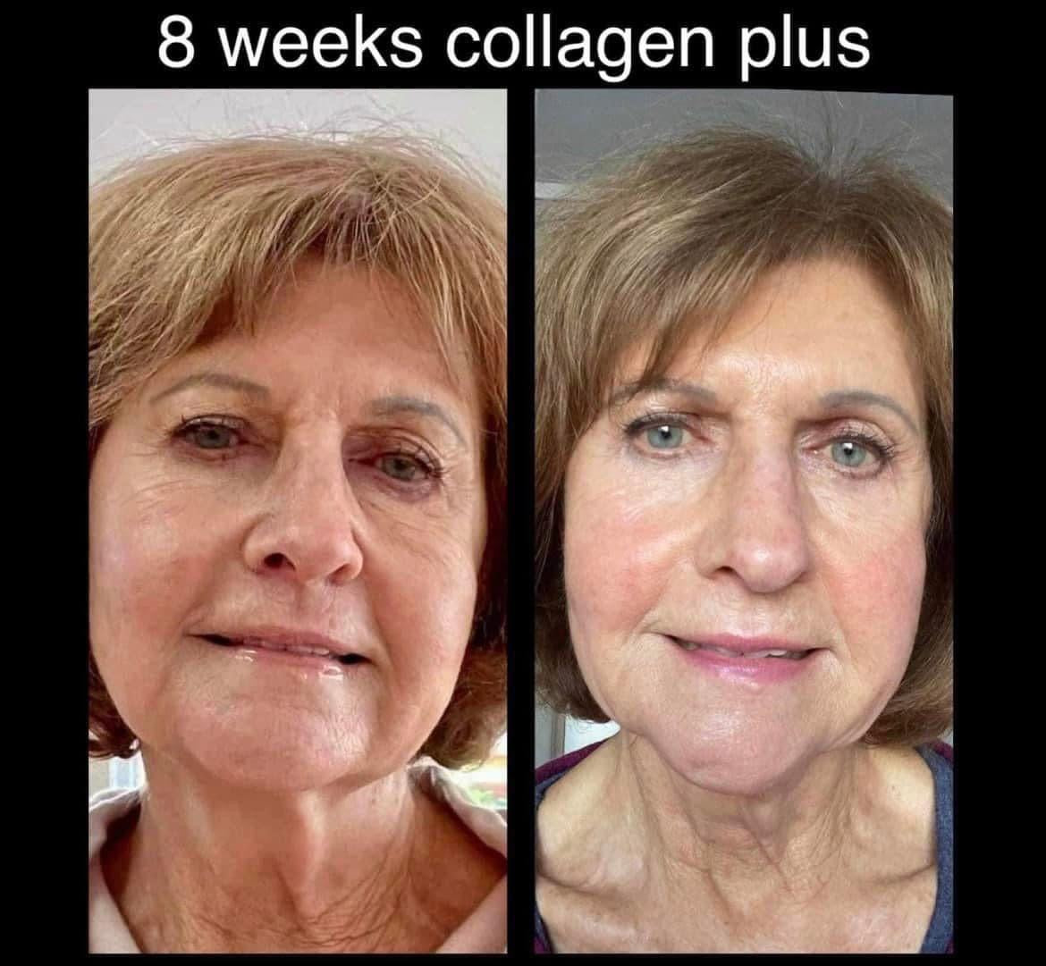 POWDER COLLAGEN