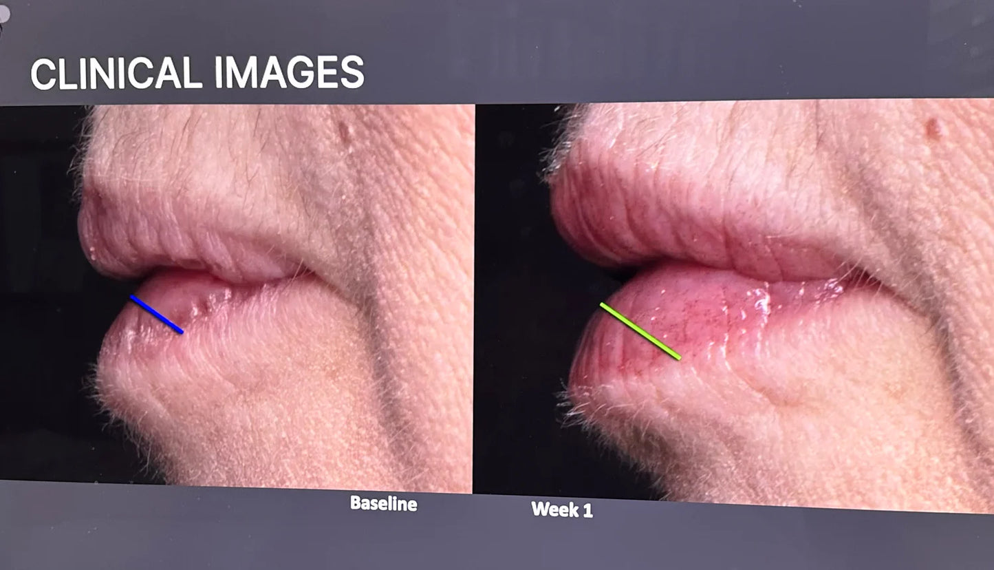 Lip Peptide Gloss