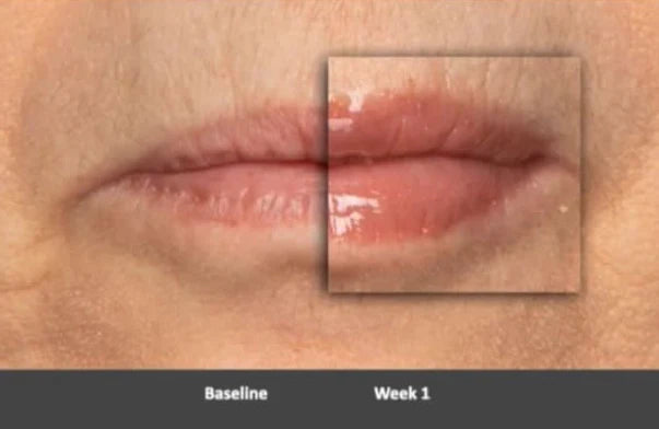 Lip Peptide Gloss